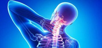 Osteokonondrosaren cervikalaren arrazoiak