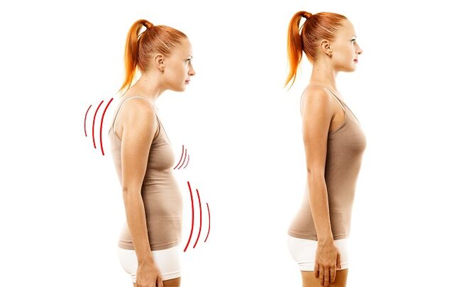 Lumbar osteochondrosisaren garapenaren kausa gisa