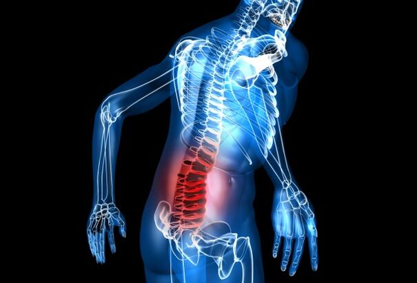 zer da lumbar osteokondrosia